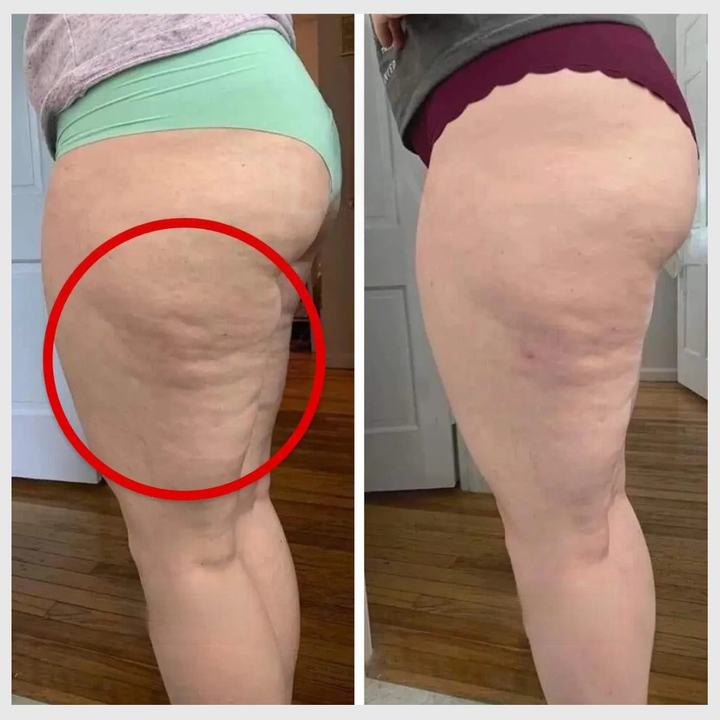Legging 3D Anticellulite – Effet Peau Lissée