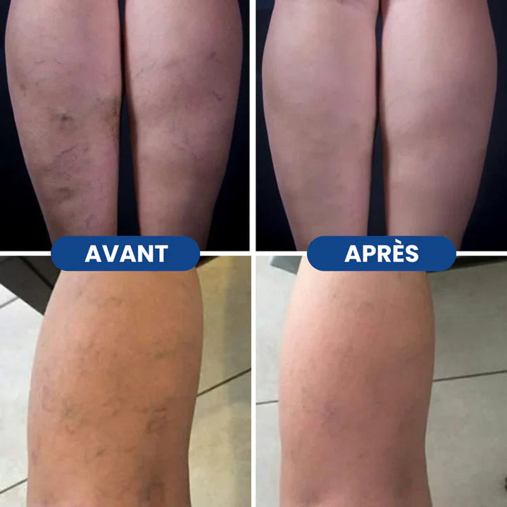 Charlie-quebec™ – Bas de Compression Confort+